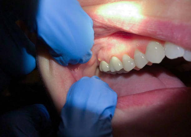 Best Emergency Cosmetic Dentistry in Black Earth, WI